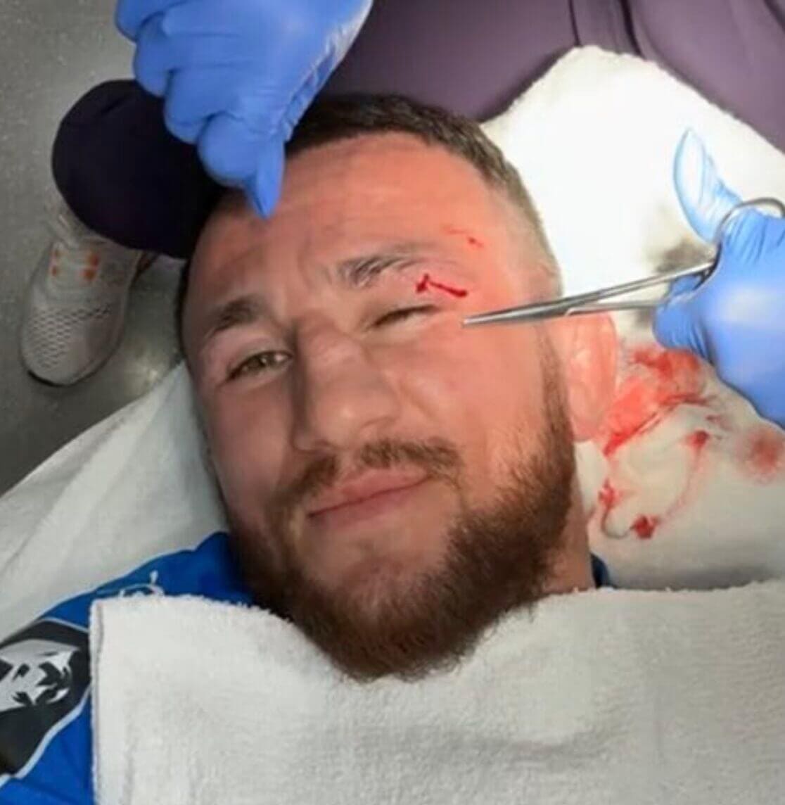 Merab Dvalishvili Cuts Himself, Dana White Reacts - 'He Posted It, So Dumb, Stupid'