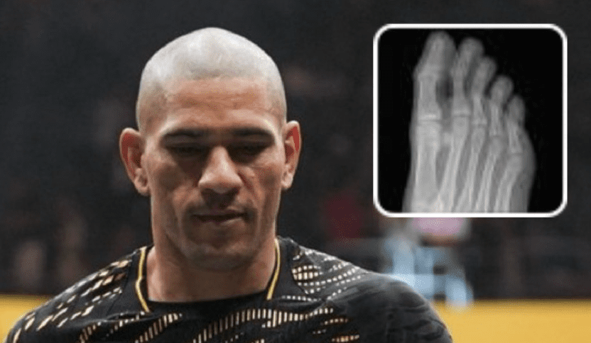 Alex Pereira Suffers A Massive Setback