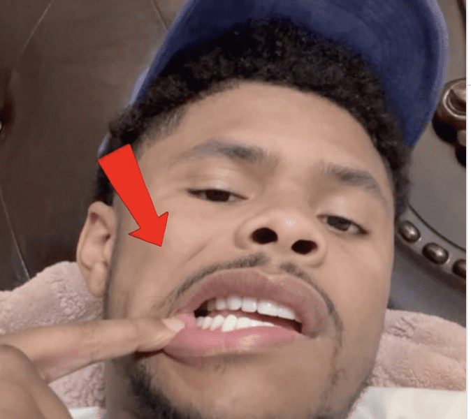 Garcia Threatens To Reshape Shakur's Teeth – ‘I’ll Put That Gap Right Back'